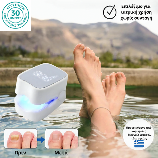 Prevazen™ - Λέιζερ για Μυκητίαση Νυχιών