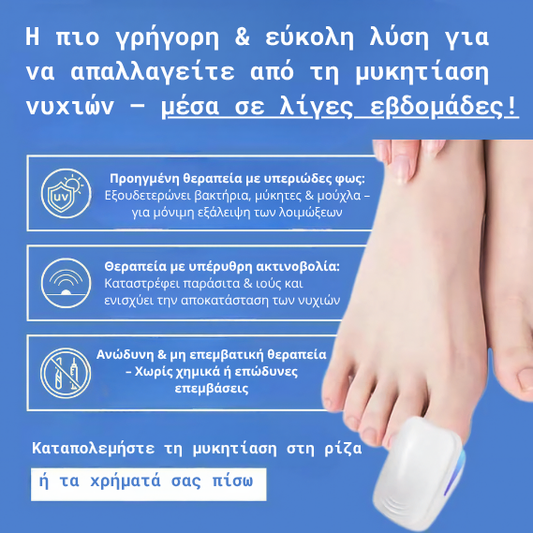 Prevazen™ - Λέιζερ για Μυκητίαση Νυχιών