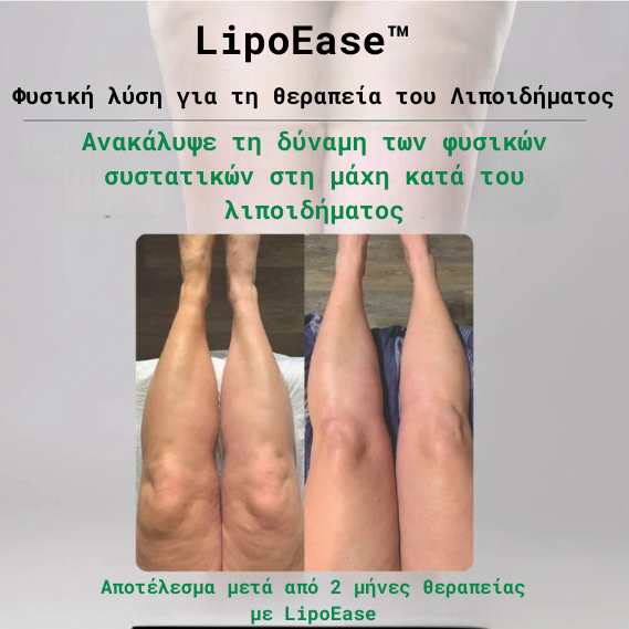 LipoEase™ — Φυσική Ρουτίνα Ανακούφισης για Λιποίδημα
