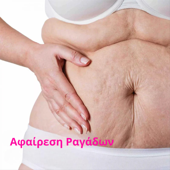 Λάδι Σώματος Κολλαγόνου  Για Αίσθηση Σφριγηλότητας & Ανόρθωσης