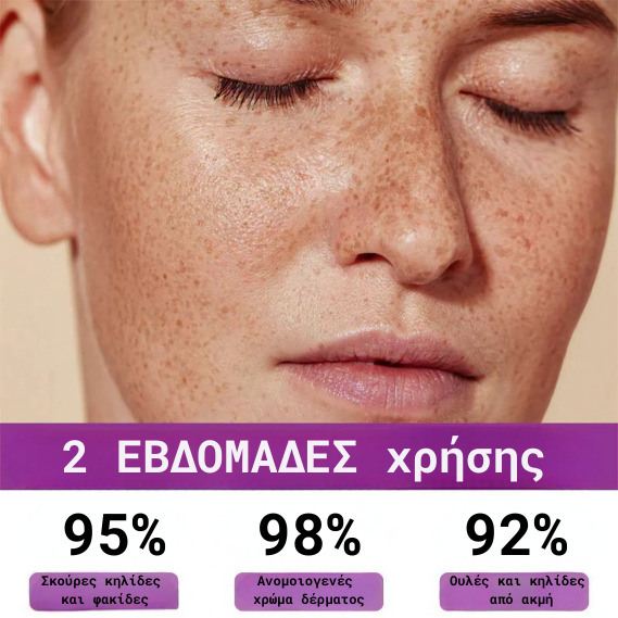 Προηγμένο Serum Κατά της Υπερμελάγχρωσης