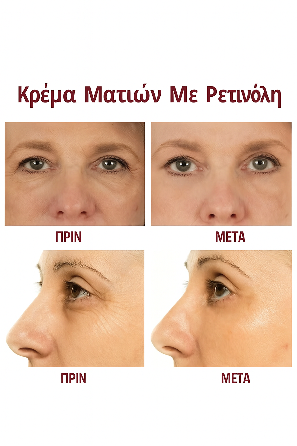 Κρέμα Ματιών για Σακούλες, Μαύρους Κύκλους & Ρυτίδες