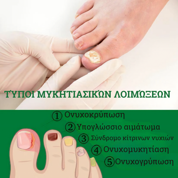 Πολυτελής θεραπεία νυχιών 7 ημερών 