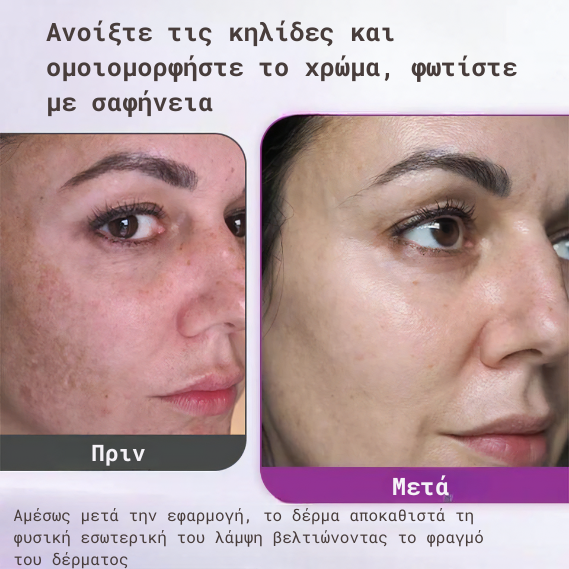 Προηγμένο Serum Κατά της Υπερμελάγχρωσης 
